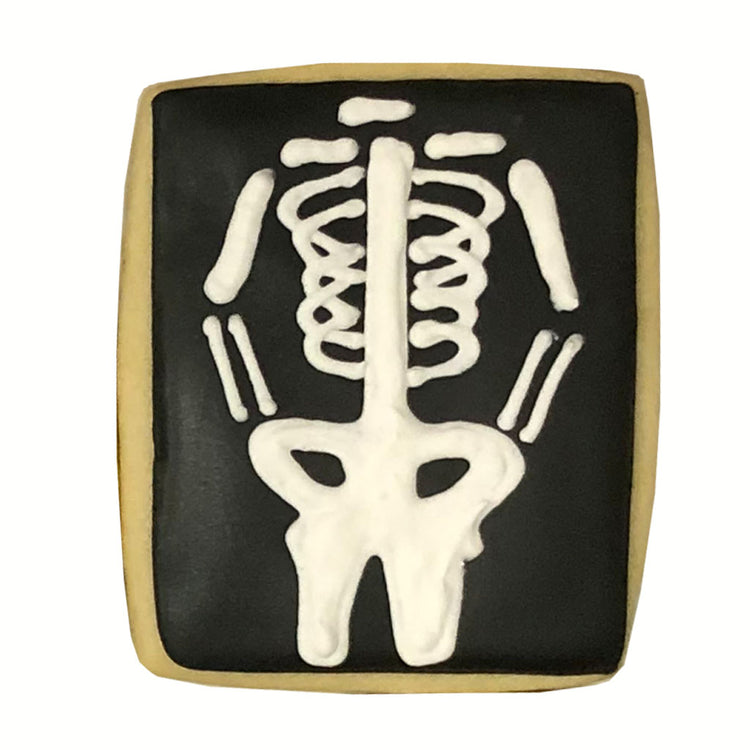 WOCO_-_xray.jpg